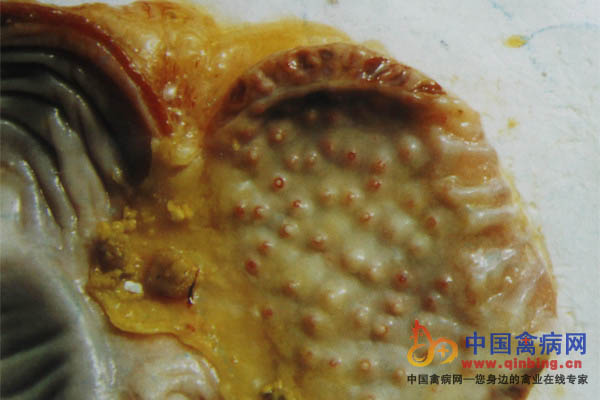 感染禽流感病鸡腺胃肿胀，乳头化脓性出血
