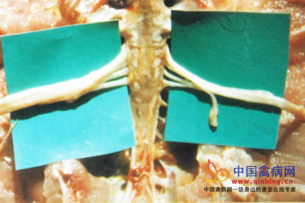 神经型病鸡左侧坐骨神经肿胀变粗，肿胀神经粗度是正常神经的2～3倍，神经纤维横纹消失，呈灰白色或黄白色