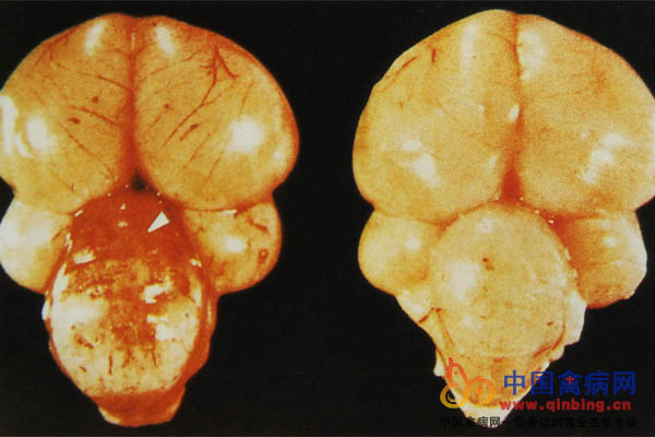 维生素E缺乏病雏鸡小脑水肿，出血。右侧为正常对照